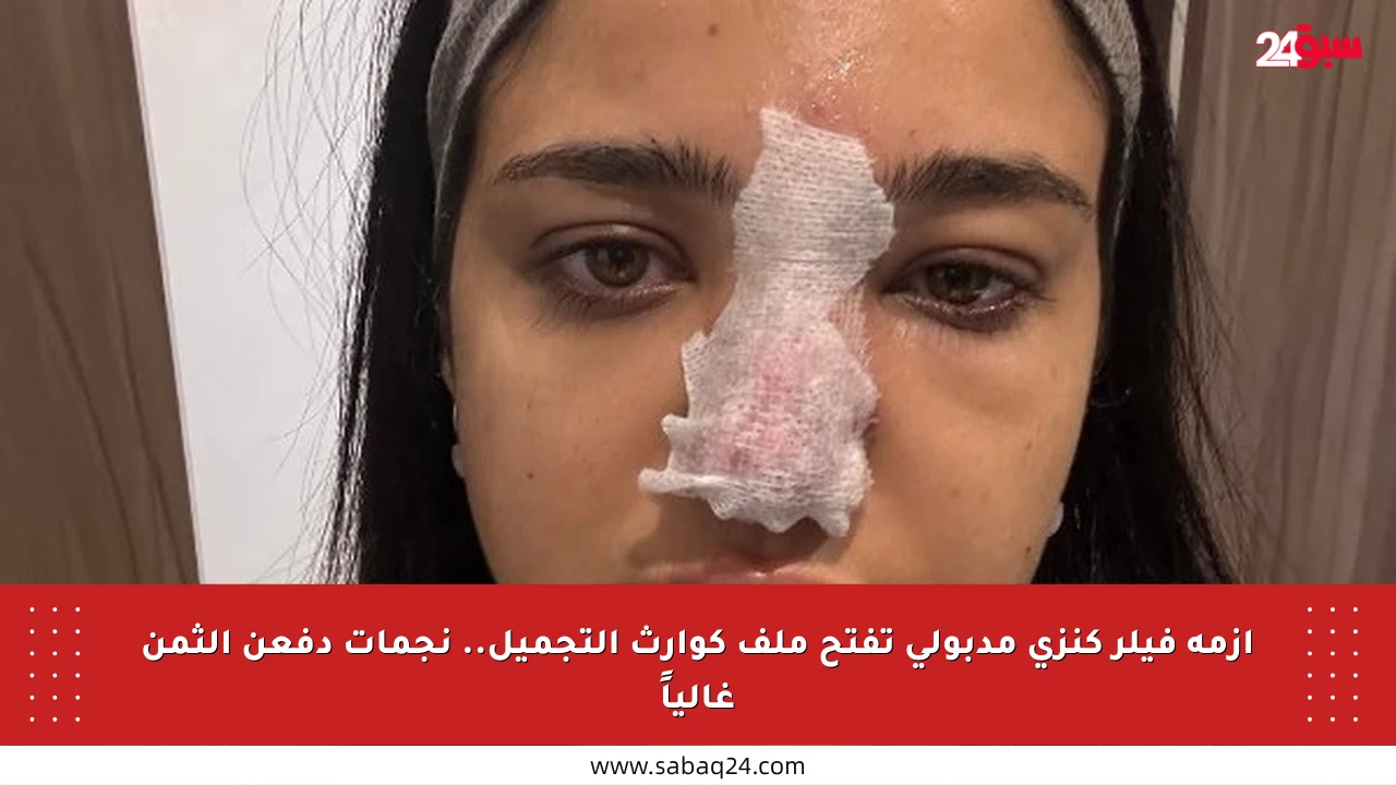 أزمة فيلر كنزي مدبولي تفتح ملف كوارث التجميل.. نجمات دفعن الثمن غالياً